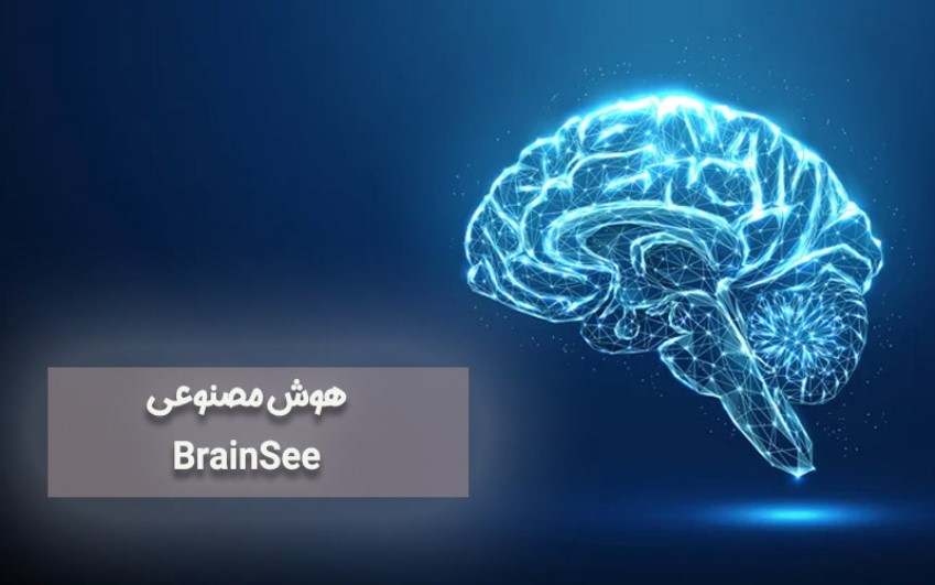 هوش مصنوعی BrainSee – پشتیبانی کامپیوتری به صورت تلفنی